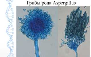 Грибы аспергилл: строение, фото, какие заболевания взывает, как лечится