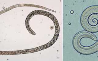 Почему появляются глисты у человека и домашних животных: причины частых заражений