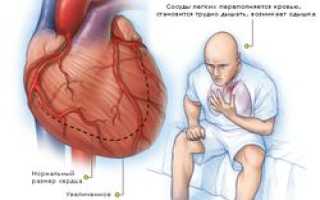 Диагностика и лечение застойной сердечной недостаточности