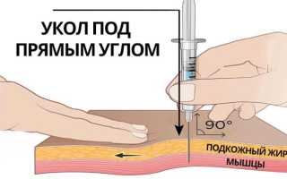 Уколы прогестерон — для чего колят прогестерон, побочные эффекты