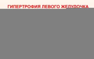 Патологии сердца: гипертрофия