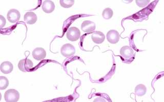 Trypanosoma cruzi: жизненный цикл, какие заболевания вызывает, методы лечения