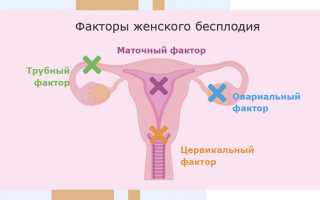 Цервикальный фактор бесплодия что это