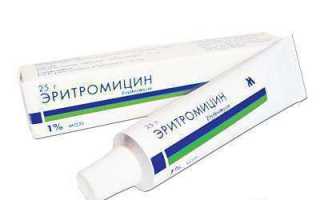 Эритромициновая мазь от прыщей