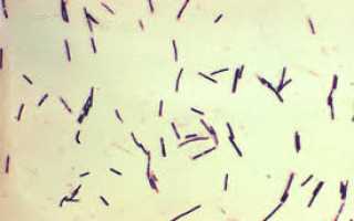 Патогенные клостридии: общие свойства, тип дыхания бактерий