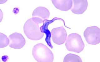 Trypanosoma Brucei Gambiense: жизненный цикл развития, локализация в теле, лечение