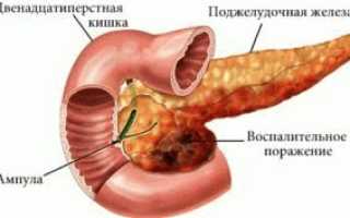 Выпадение волос при диабете как с этим бороться