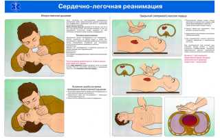 Правила проведения искусственного дыхания и непрямого массажа сердца