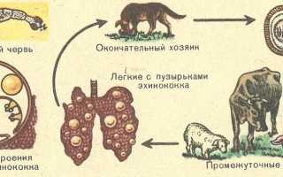 Эхинококкоз и его симптомы у человека