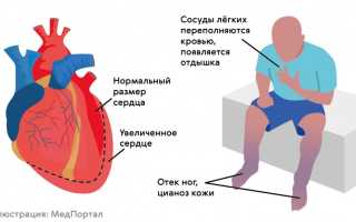 Разновидности, причины и диагностика блокад сердца