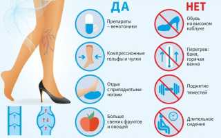 Варикоз: определяем и учимся бороться