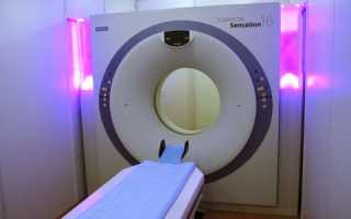 Виды МСКТ и СКТ легких