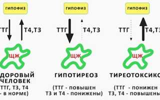 Свободный гормон тироксин — норма у женщин