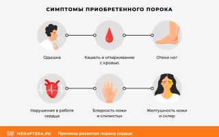 Какие симптомы говорят о развитии порока сердца?