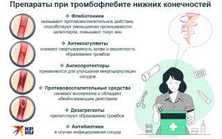 Лекарственные средства, назначаемые при тромбофлебите и их особенности