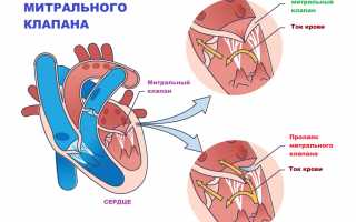 Пролапс митрального клапана: опасен или нет?