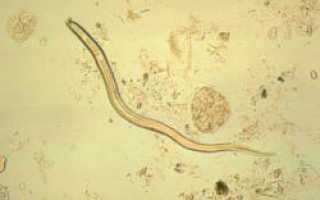 Кишечная угрица (Strongyloides stercoralis) у детей и взрослых: симптомы и лечение