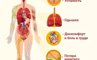 Сердечная недостаточность у мужчин: симптомы и способы предупреждения