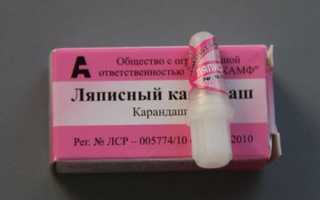 Специальные карандаши для удаления бородавок
