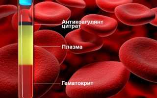 Почему повышается гематокрит, методы диагностики и лечения, в чем опасность отклонений