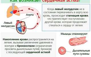 Сердечная астма симптомы и лечение у взрослых