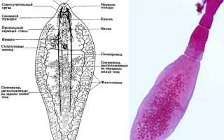 Дигенетические сосальщики: характеристика представителей, пути заражения, симптомы и лечение