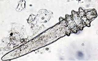 Demodex brevis: строение паразита, диагностика и как лечить