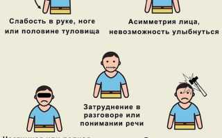 Правосторонний инсульт: каких ждать последствий?