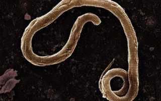 Какие черви могут быть в ногах: описание паразитов, пути заражения, лечение