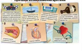 В чем причина возникновения аритмии после еды?