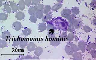 Trichomonas Hominis у человека: описание паразита, жененный цикл, пути заражения
