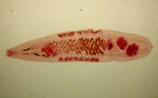 Лечение описторхоза у взрослых в домашних условиях
