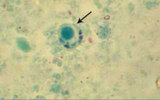 Blastocystis Spp у человека: лечение у детей и взрослых, симптомы, пути заражения