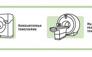 КТ или МРТ малого таза: какой метод информативней и безопасней