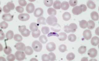 Plasmodium ovale: возбудитель, морфология, симптомы и лечение