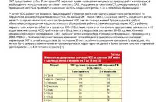 Брадикардия: особенности аритмии у детей