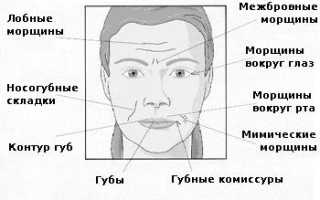 О чем говорят морщины на лице у женщины