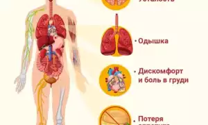 Сведения о сердечно-сосудистой недостаточности: есть ли повод для волнений?