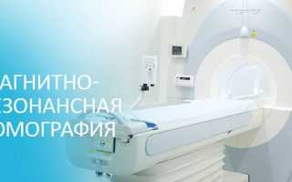 Частота прохождения МРТ