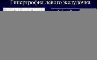 Увеличение левого предсердия: причины, симптомы, диагностика и лечение