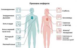 Как проявляется симптоматика инфаркта миокарда у женщин и что следует делать в первую очередь?