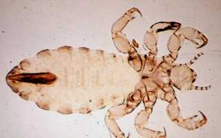 Pediculus Humanus Humanus: описание паразита, жизненный цикл и пути заражения