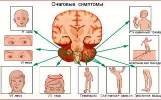 Стволовая симптоматика