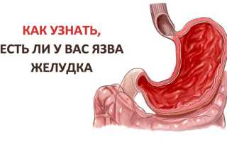 Язва желудка: симптомы, лечение, диета, народные средтва