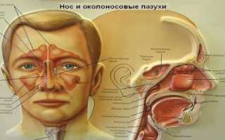 Хронический риносинусит: формы, симптомы, лечение