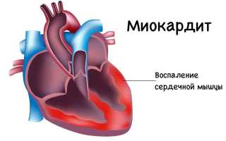 Почему может щемить сердце?