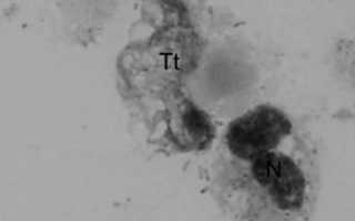 Trichomonas tenax: внешний вид, жизненный цикл развития и методы лечения