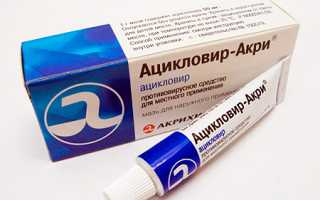 Как лечить герпес в носу?
