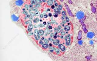 Chlamydia pneumoniae у детей и взрослых: исследование антител, методы лечения