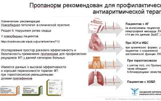 В каких случаях назначают «Дигоксин» при мерцательной аритмии?